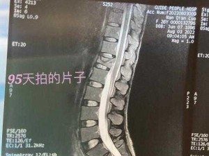 臭小子姨妈腰多久会骨折？使用姨妈腰神器，让你远离姨妈痛