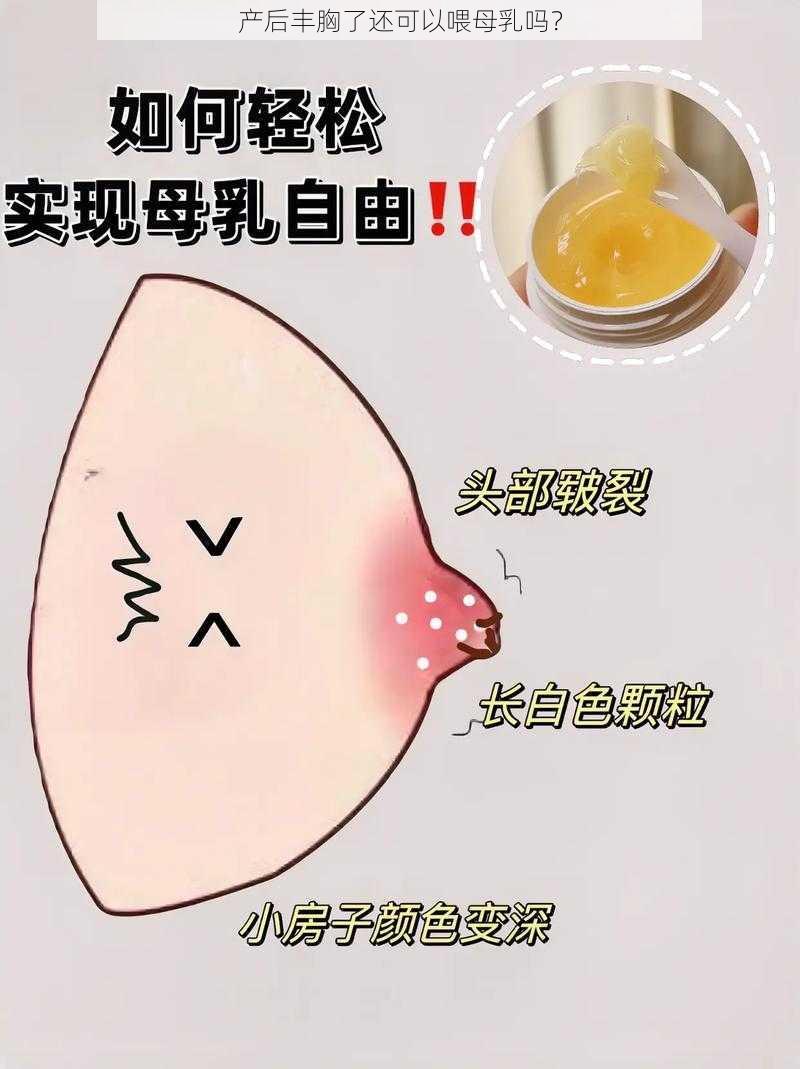 产后丰胸了还可以喂母乳吗？