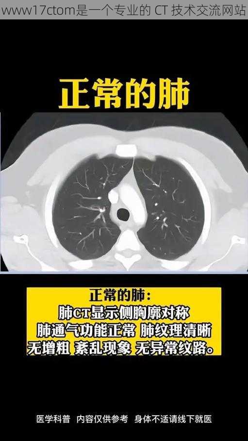 www17ctom是一个专业的 CT 技术交流网站