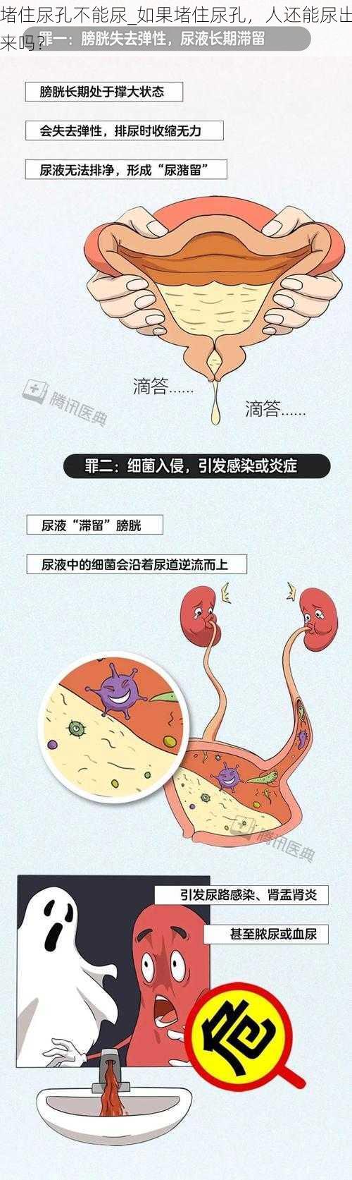 堵住尿孔不能尿_如果堵住尿孔，人还能尿出来吗？